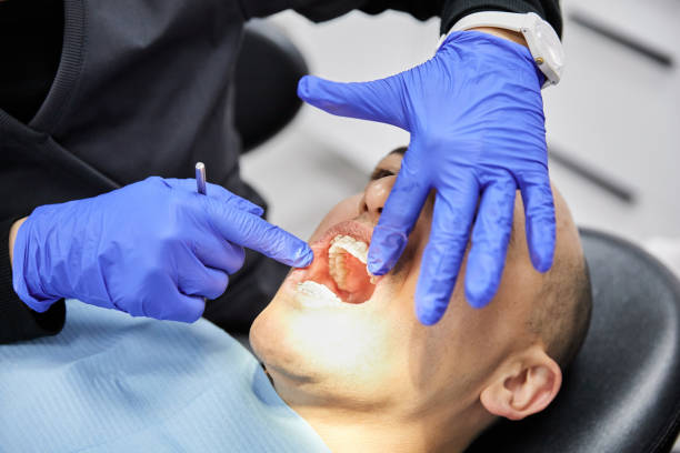Best Emergency Treatment for Dental Infections or Abscesses in Boscobel, WI